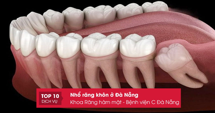 khoa-rang-ham-mat-benh-vien-c-da-nang-top10danang