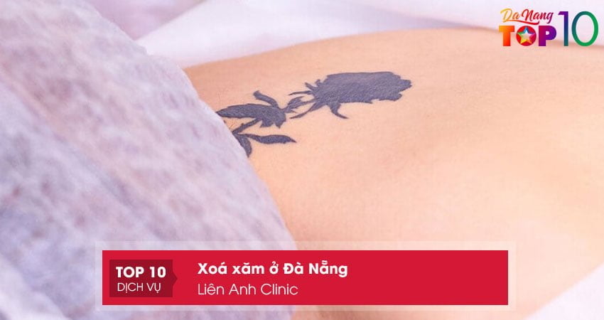 lien-anh-clinic-top10danang