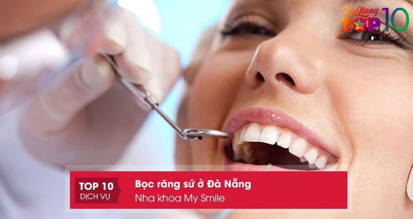 nha-khoa-my-smile-top10danang