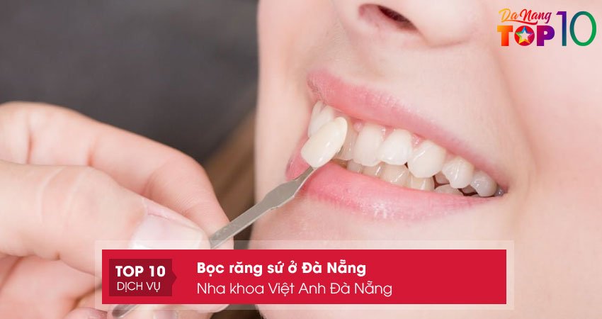 nha-khoa-viet-anh-da-nang-top10danang