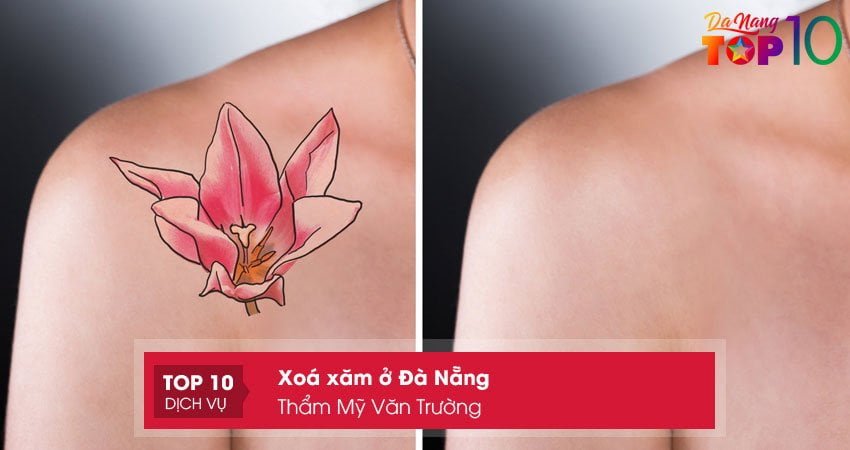 tham-my-van-truong-xoa-xam-o-da-nang-khong-de-lai-seo-top10danang