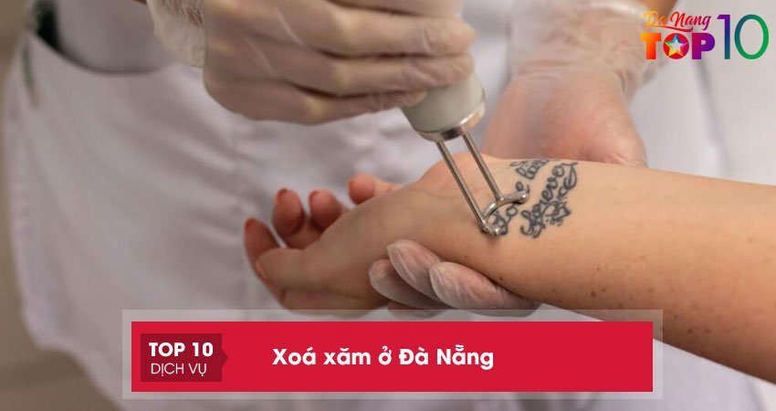 Top 10 địa chỉ xoá xăm ở Đà Nẵng AN TOÀN hiệu quả